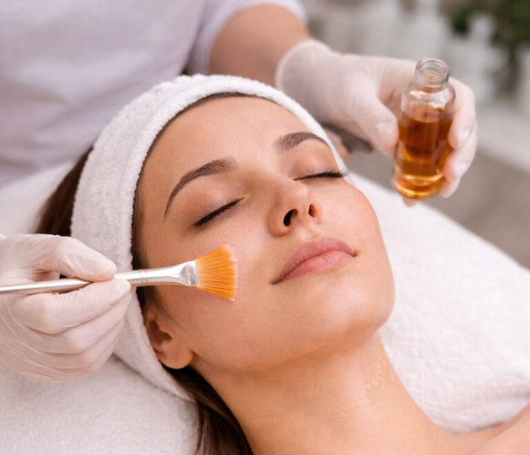 Χημικό Peeling/Οξέα
